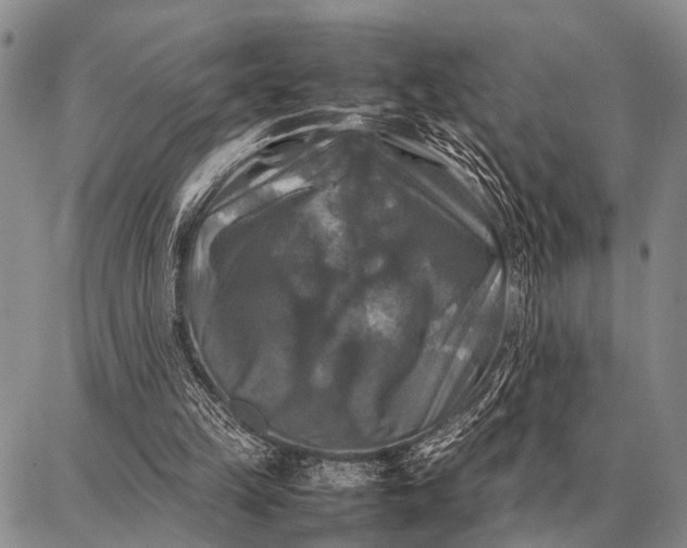 X0000087710149200705181853