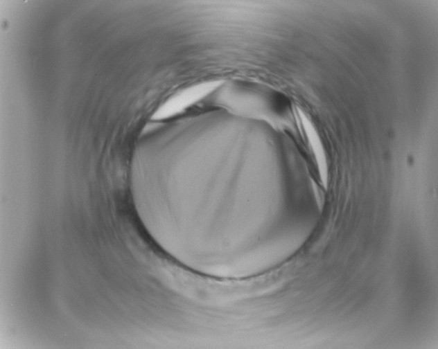 X0000087710039200706011821