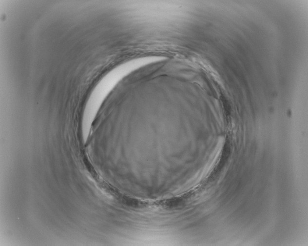X0000087710593200706011812