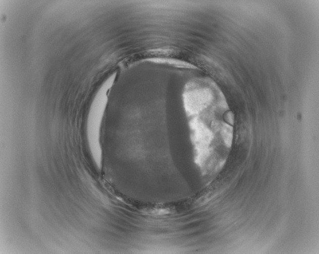 X0000087710647200706011811
