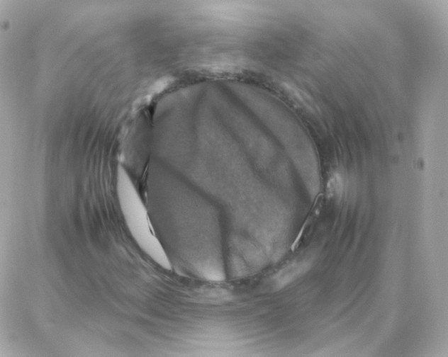 X0000087711156200706011802