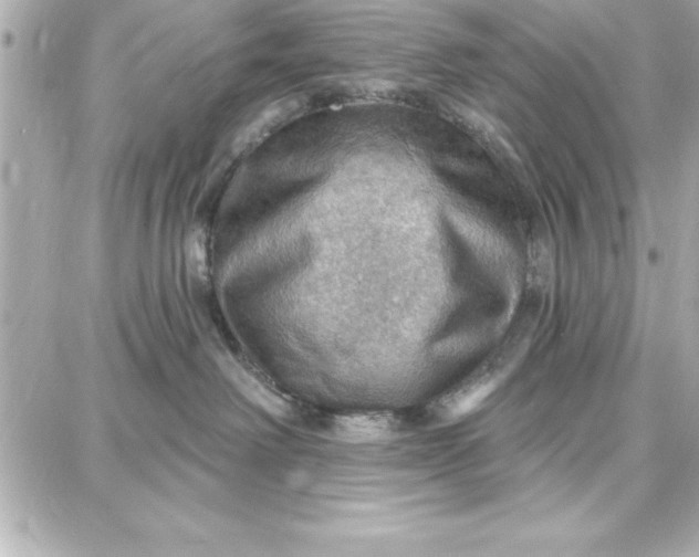 X0000087740238200705211020