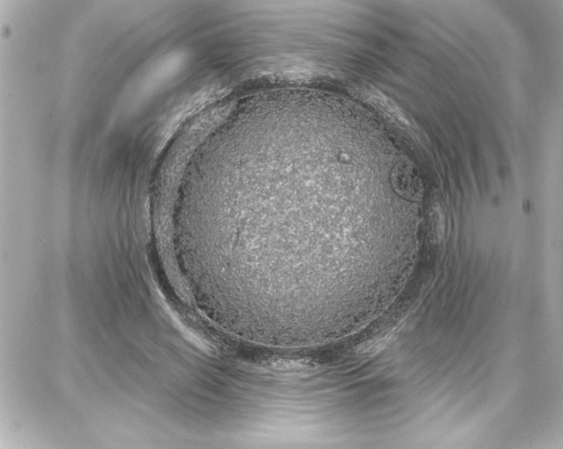 X0000087740638200705211013