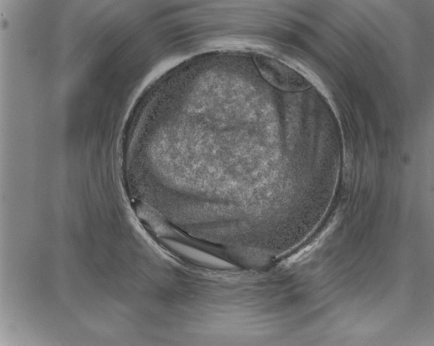 X0000087741045200705211007