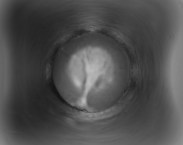 X0000087740043200705291022