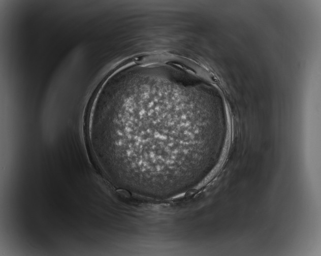 X0000087740147200705291020