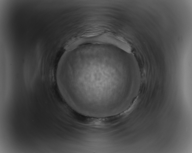 X0000087740182200705291020