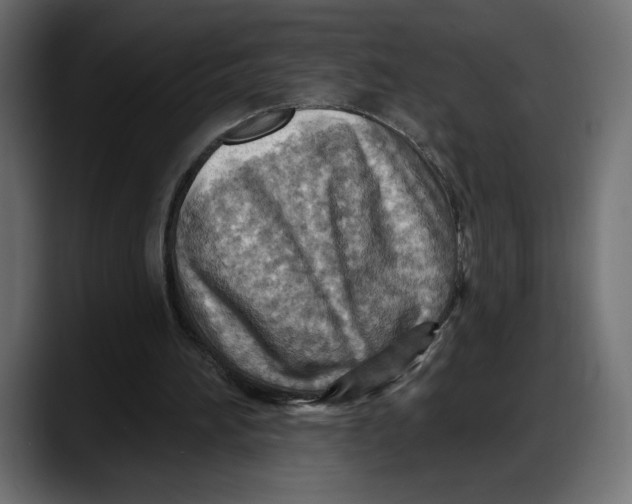 X0000087740196200705291020