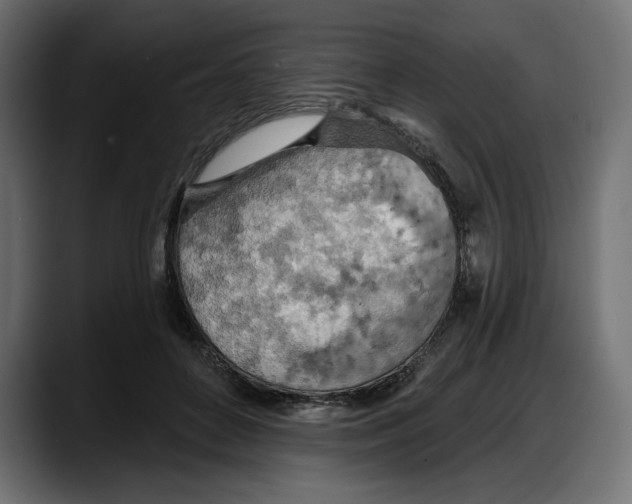 X0000087740504200705291016