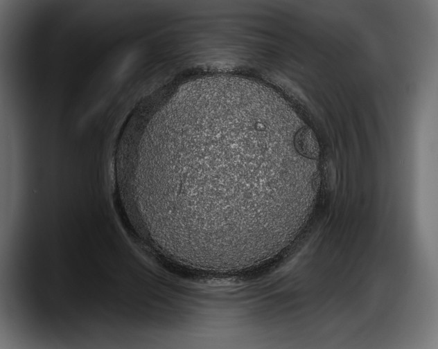 X0000087740638200705291013