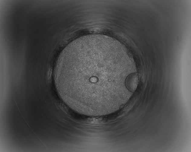 X0000087740660200705291014