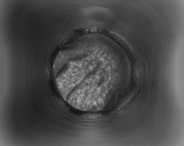 X0000087740661200705291014