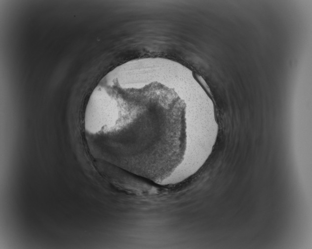 X0000087741009200705291008