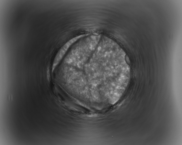 X0000087741106200705291007