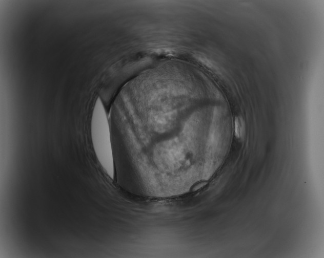 X0000087741155200705291007
