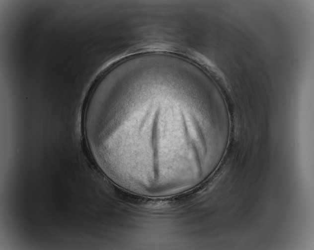 X0000087741174200705291007