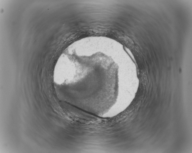 X0000087741009200706041031