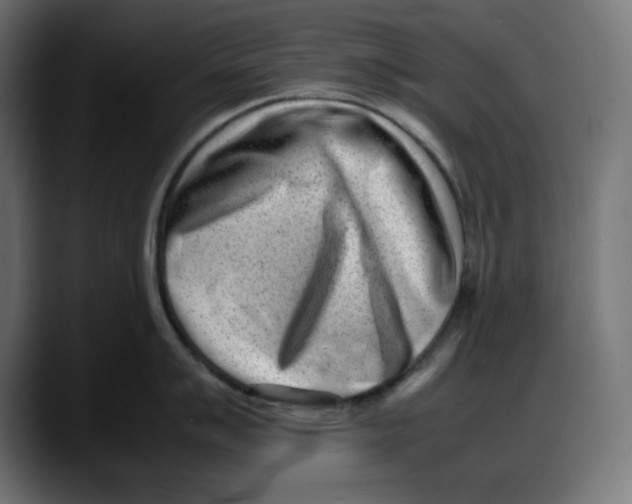 X0000087751007200705291029