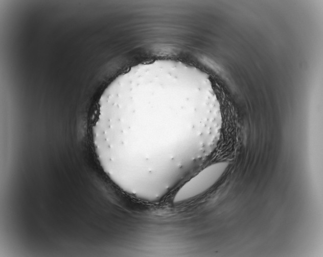 X0000088020407200706081445