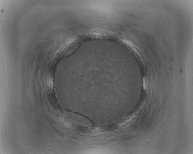 X0000088031155200705182018