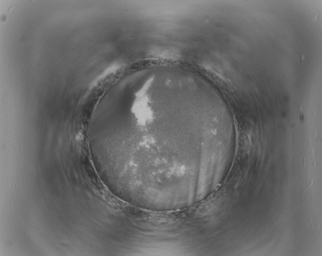 X0000088031254200705182017