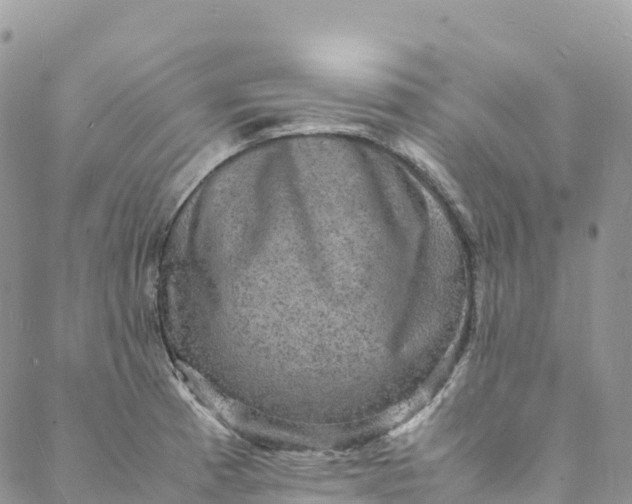 X0000088031185200705251109