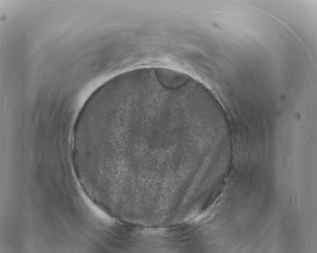 X0000088031519200705251104