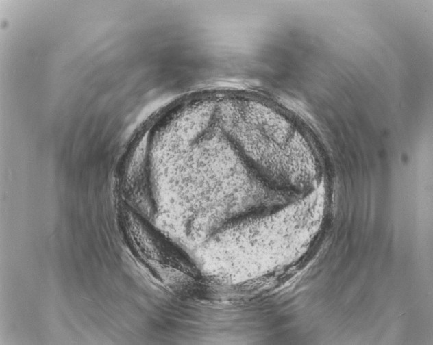 X0000088031404200706011338