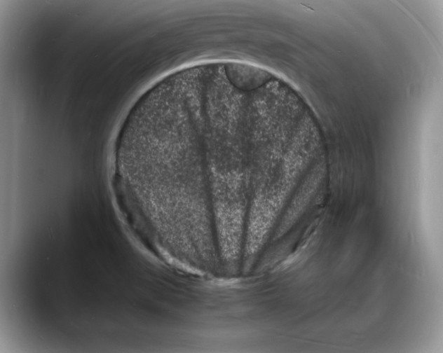 X0000088031519200706081451