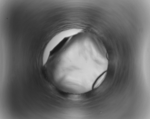 X0000088040139200706011331