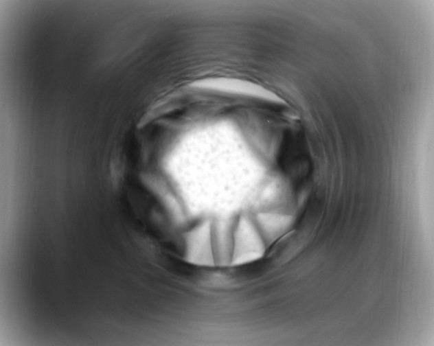 X0000088040285200706011329