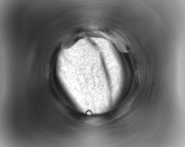 X0000088040458200706011327