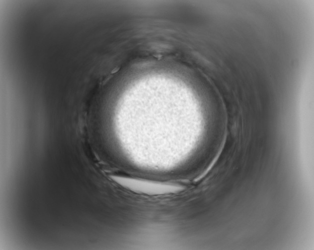 X0000088041397200706011315