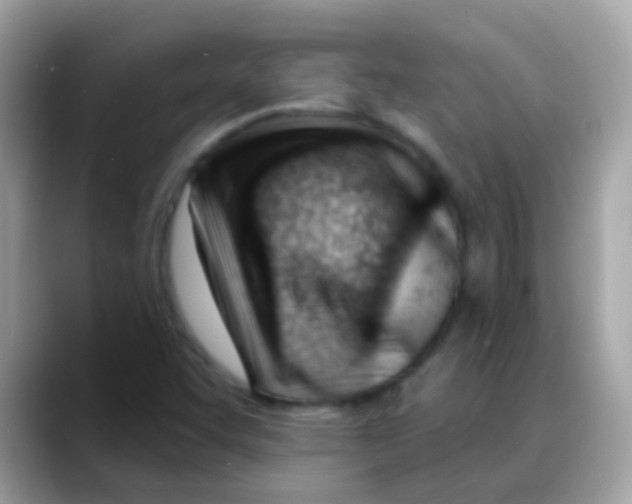 X0000088041455200706011315