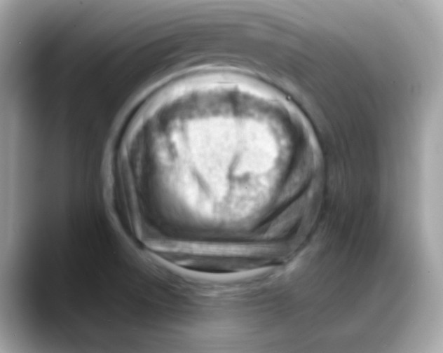 X0000088041522200706011314