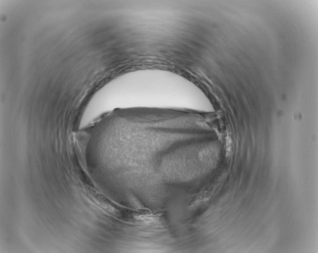 X0000088060516200706011452
