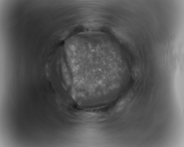 X0000088071010200706081705