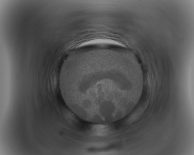 X0000088130139200705211123