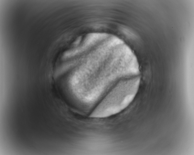 X0000088131014200706041315