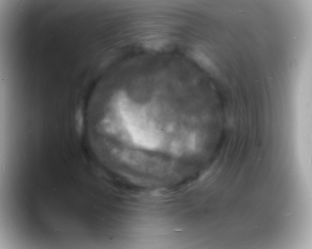 X0000088131106200706041314