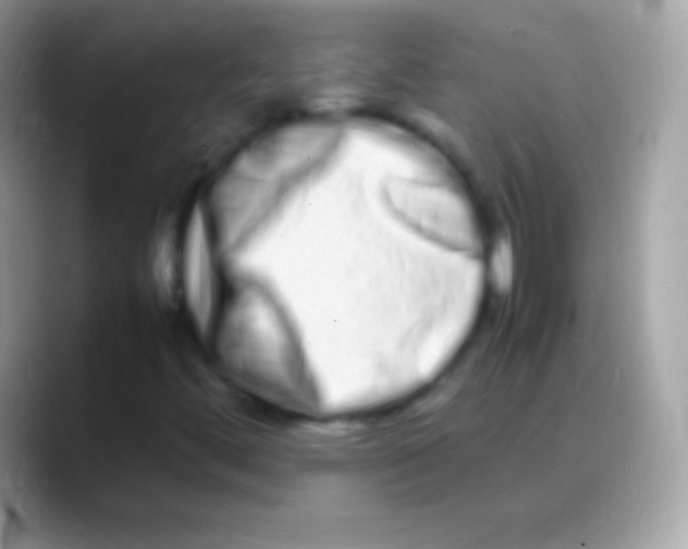 X0000088131444200706041310