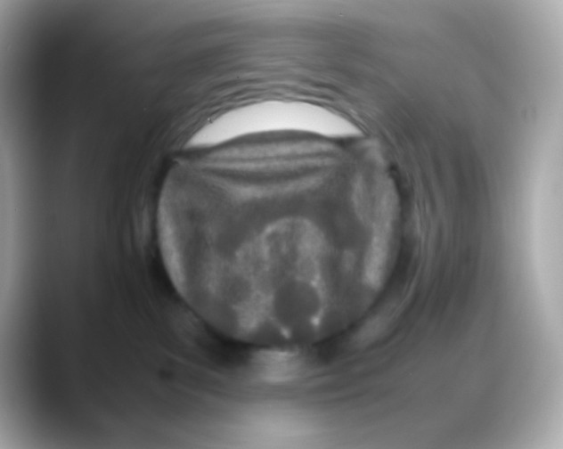 X0000088130139200706041956