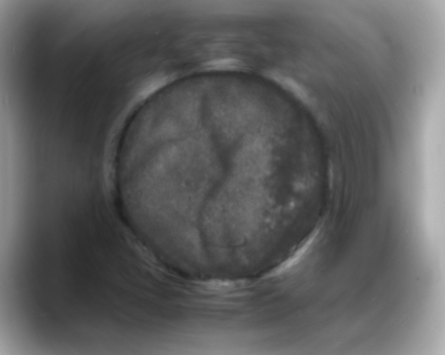 X0000088131405200706041939