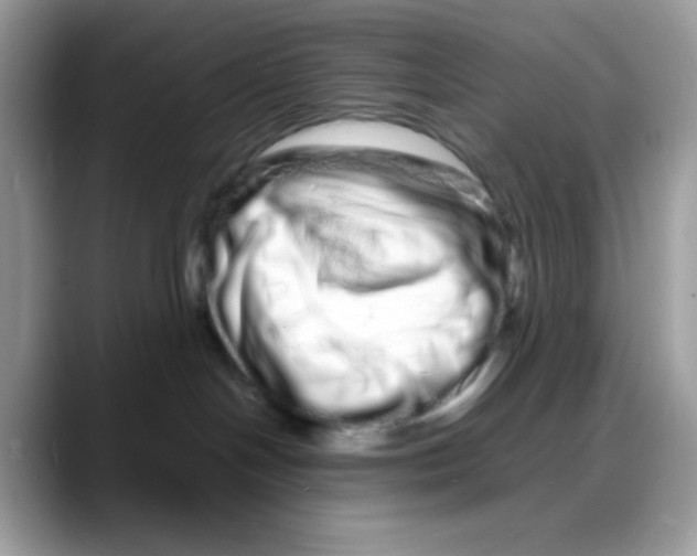 X0000088130094200706111415