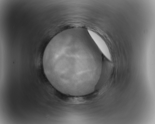 X0000088130517200706111409