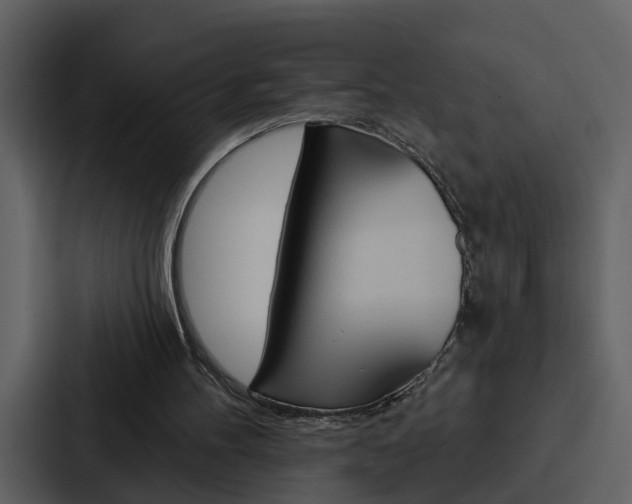 X0000088140100200705141039
