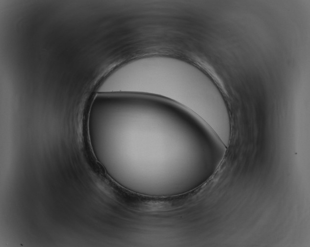 X0000088140154200705141038