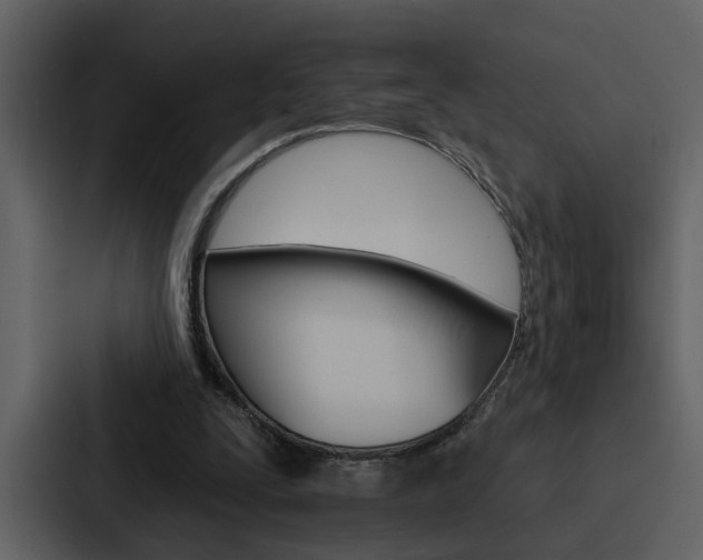 X0000088140295200705141037