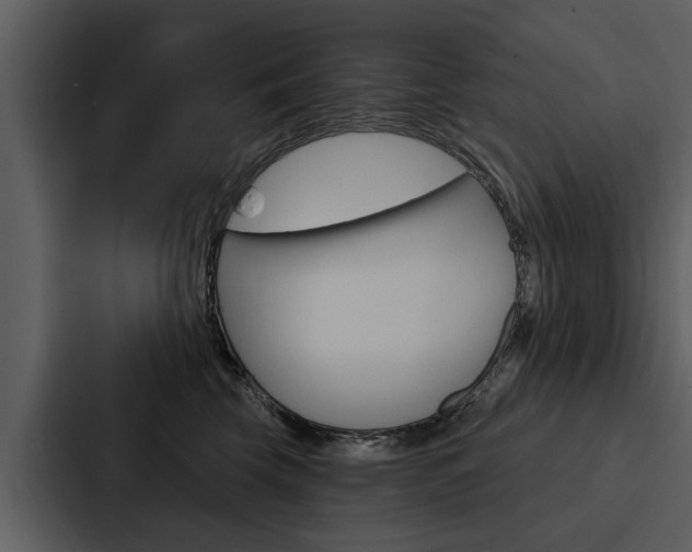 X0000088140569200705141034