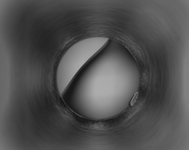 X0000088140600200705141033